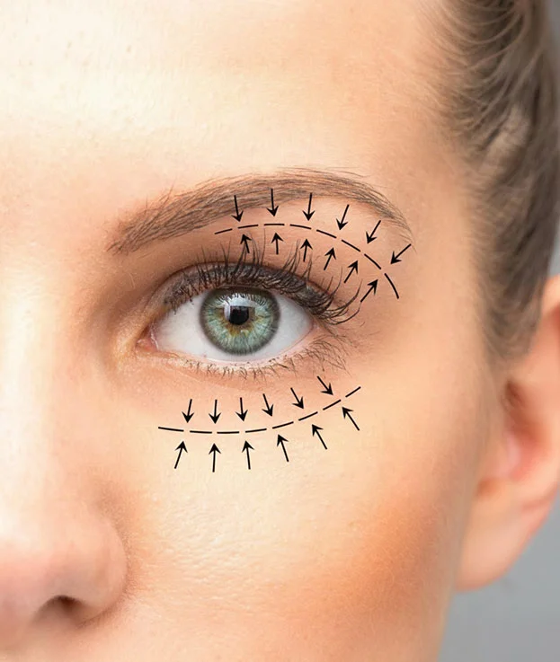 Blefaroplastia